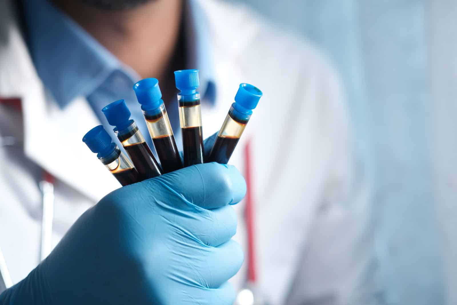 Clinician holding blood sample tubes for ongoing Clinician holding blood sample tubes for ongoing TRT monitoring and follow-up testing